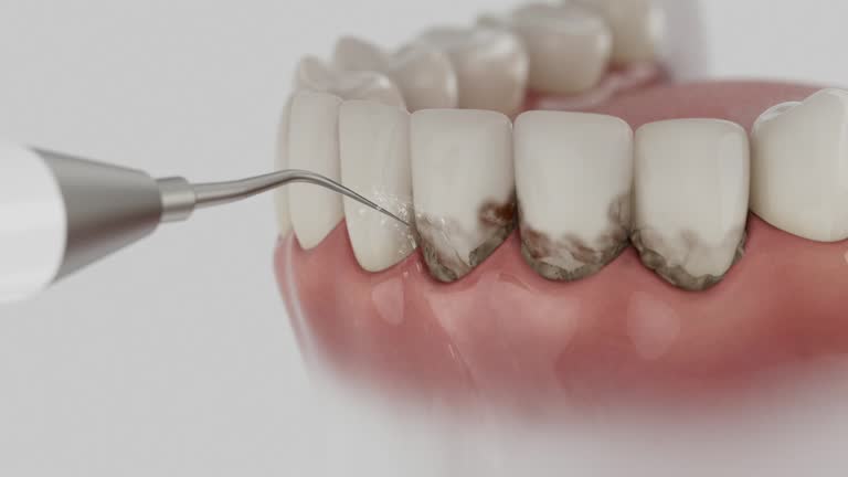 Trusted Teeth Cleaning And Checkup service in Woods Cross, UT - Dentist Open Now